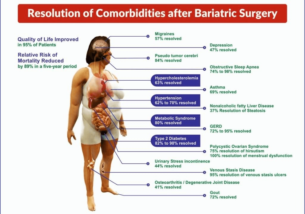 Bariatric-Surgery-Punjab-India