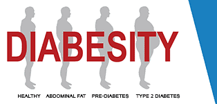 Bariatric surgery for Diabetes