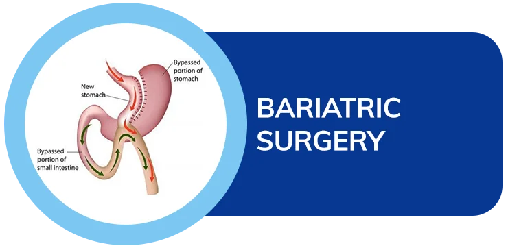 bariatric surgery