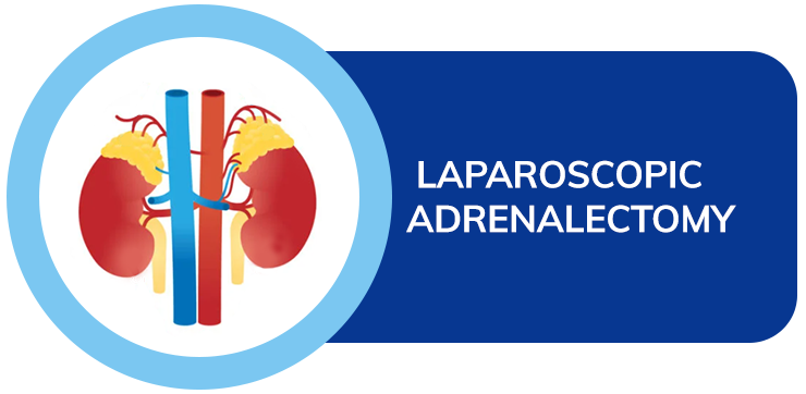 Laparoscopic adrenalectomy dr amit sood ckosmic health city