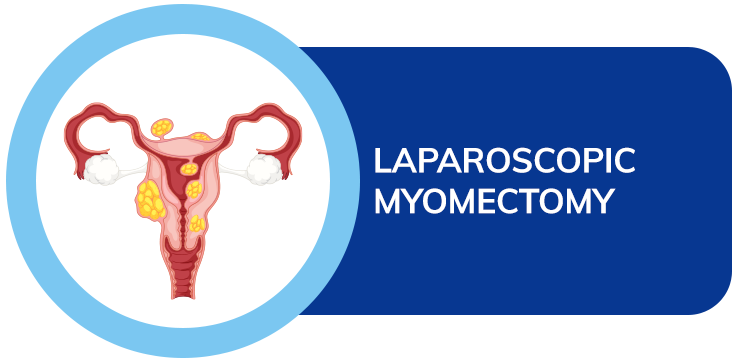 Laparoscopic-myomectomy-dr amit sood best bariatric surgeon in punjab