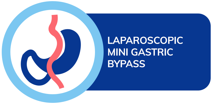 dr amit sood best bariatric surgeon Laproscopic Mini Gastric Bypass