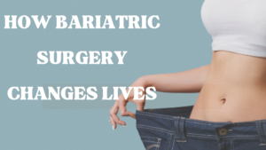 Bariatric Surgery in Punjab