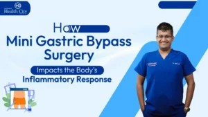 Mini Gastric Bypass Surgery