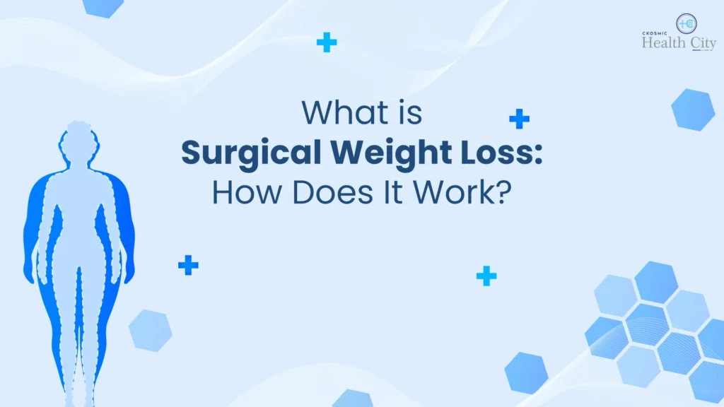 Surgical Weight Loss - Dr Amit Sood