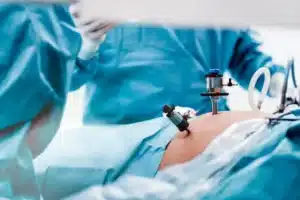 Best Weight loss surgeon in Tarn Taran