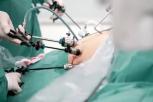 Best Weight Loss Surgeon in Batala