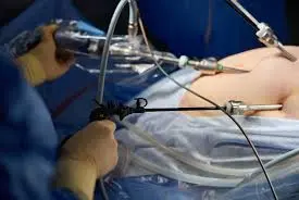 Is Bariatric Surgery Safe? Key Facts You Should Know